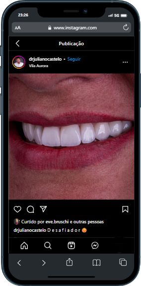 mobile